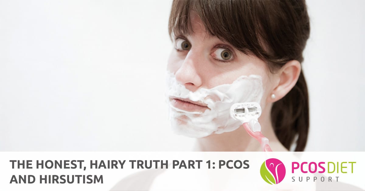 Pcos without hirsutism