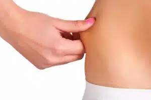 women pinching body fat