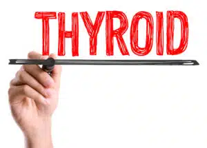 PCOS and Alopecia thyroid