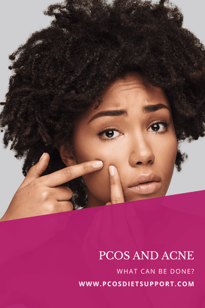 Pcos And Acne What Can Be Done Pcos Diet Support