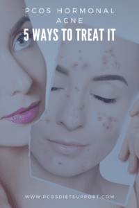 PCOS Hormonal Acne - 5 ways to treat it 